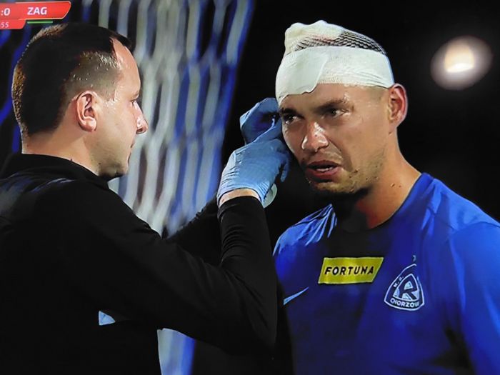 Piłkarz stracił przytomność podczas meczu Fortuna 1 Ligi (VIDEO)