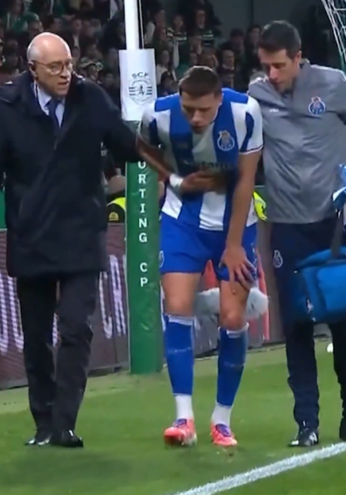 Szpital w kadrze przed meczem z Albanią. Lewy z pękniętą kością i kłopoty obrońców