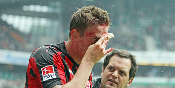 Brutalny faul w Bundeslidze. Boli od patrzenia. VIDEO